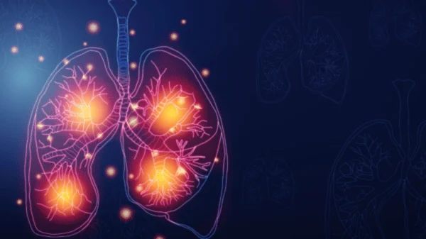 Graphical Image showing asthma caused by covid infection